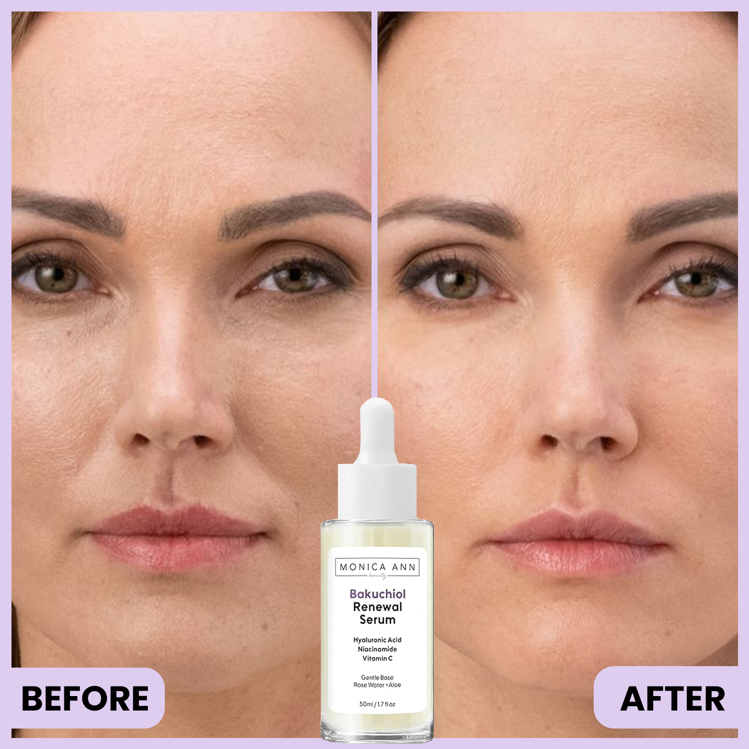 NOW AVAILABLE! Bakuchiol Renewal Serum with Hyaluronic Acid, Niacinamide, and Vitamin C, 50ml
